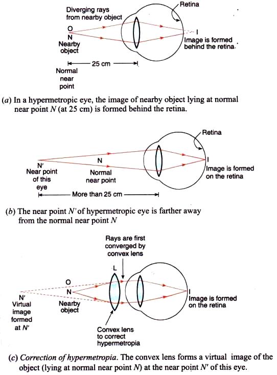 lakhmir singh manjit kaur physics class 10 Chapter 6 page 279 Q23