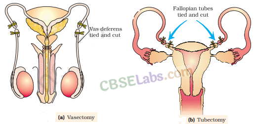 Reproductive Health - CBSE Notes for Class 12 Biology img-1